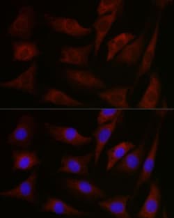 Invitrogen PKC Pan Polyclonal Antibody 100 &mu;L; Unconjugated:Antibodies,