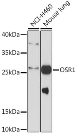 Invitrogen OSR1 Polyclonal Antibody 100 &mu;L | Buy Online | Invitrogen&trade; | Fisher Scientific