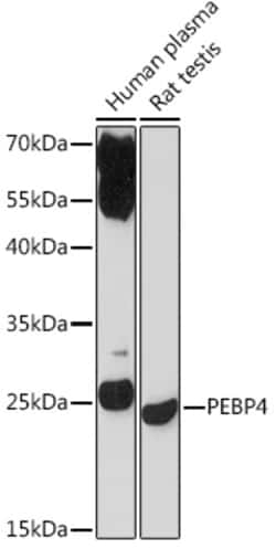 Invitrogen PEBP4 Polyclonal Antibody 100 &mu;L; Unconjugated:Antibodies,