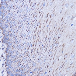 Invitrogen MT-ND1 Polyclonal Antibody 100 &mu;L; Unconjugated:Antibodies,