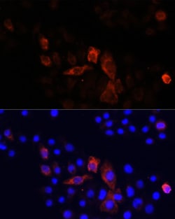 Invitrogen MT-ND2 Polyclonal Antibody 100 &mu;L; Unconjugated:Antibodies,