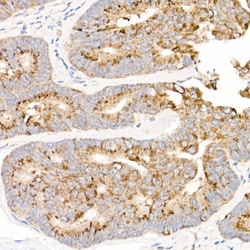 Invitrogen MT-ND2 Polyclonal Antibody 100 &mu;L; Unconjugated:Antibodies,