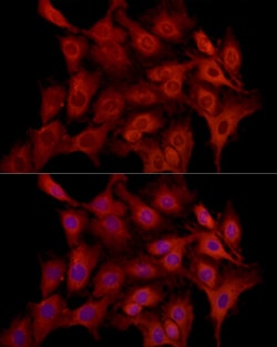 Invitrogen MCL-1 Polyclonal Antibody 100 &mu;L; Unconjugated:Antibodies,