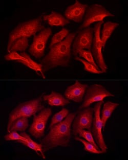 Invitrogen MCL-1 Polyclonal Antibody 100 &mu;L; Unconjugated:Antibodies,