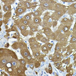 Invitrogen NNMT Polyclonal Antibody 100 &mu;L; Unconjugated:Antibodies,