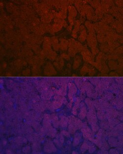 Invitrogen NNMT Polyclonal Antibody 100 &mu;L; Unconjugated:Antibodies,
