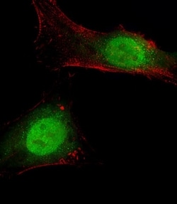 Invitrogen BAP1 Polyclonal Antibody 400 &mu;L; Unconjugated:Antibodies,