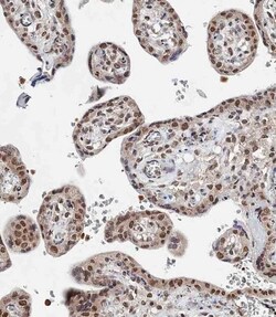 Invitrogen BAP1 Polyclonal Antibody 400 &mu;L; Unconjugated:Antibodies,