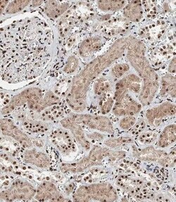 Invitrogen BAP1 Polyclonal Antibody 400 &mu;L; Unconjugated:Antibodies,