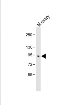 Invitrogen BAP1 Polyclonal Antibody 400 &mu;L; Unconjugated:Antibodies,
