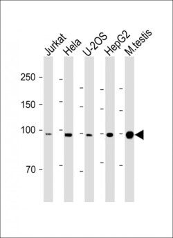 Invitrogen BAP1 Polyclonal Antibody 400 &mu;L; Unconjugated:Antibodies,