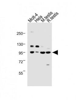Invitrogen BAP1 Polyclonal Antibody 400 &mu;L; Unconjugated:Antibodies,