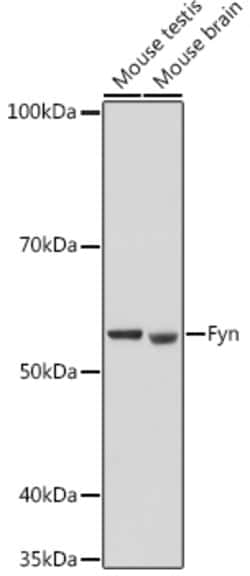 Invitrogen Fyn Polyclonal Antibody 100 &mu;L | Buy Online | Invitrogen&trade; | Fisher Scientific