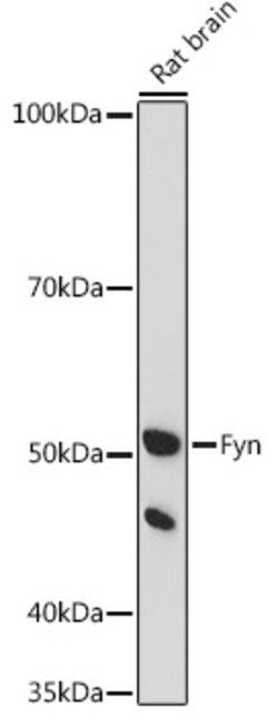 Invitrogen Fyn Polyclonal Antibody 100 &mu;L | Buy Online | Invitrogen&trade; | Fisher Scientific
