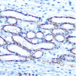 Invitrogen TBCCD1 Polyclonal Antibody 100 &mu;L; Unconjugated:Antibodies,
