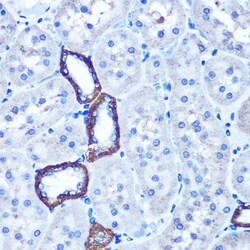 Invitrogen TBCCD1 Polyclonal Antibody 100 &mu;L; Unconjugated:Antibodies,