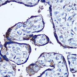 Invitrogen TBCCD1 Polyclonal Antibody 100 &mu;L; Unconjugated:Antibodies,