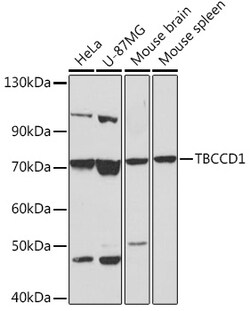 Invitrogen TBCCD1 Polyclonal Antibody 100 &mu;L; Unconjugated:Antibodies,