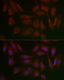 Invitrogen PERK Polyclonal Antibody 100 &mu;L; Unconjugated:Antibodies,