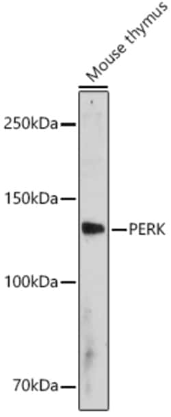Invitrogen PERK Polyclonal Antibody 100 &mu;L; Unconjugated:Antibodies,