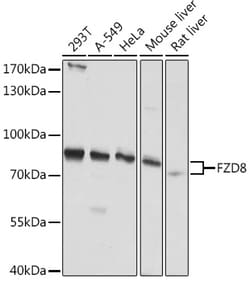 Invitrogen FZD8 Polyclonal Antibody 100 μL; Unconjugated:Antibodies,