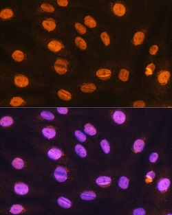 Invitrogen GTF3C3 Polyclonal Antibody 100 &mu;L; Unconjugated:Antibodies,