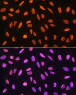 Invitrogen GTF3C3 Polyclonal Antibody 100 &mu;L; Unconjugated:Antibodies,