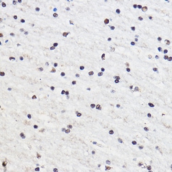 Invitrogen GTF3C3 Polyclonal Antibody 100 &mu;L; Unconjugated:Antibodies,