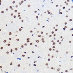 Invitrogen GTF3C3 Polyclonal Antibody 100 &mu;L; Unconjugated:Antibodies,
