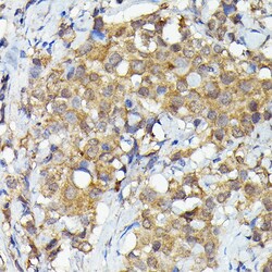 Invitrogen MNK1 Polyclonal Antibody 100 &mu;L | Buy Online | Invitrogen&trade; | Fisher Scientific