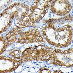 Invitrogen MNK1 Polyclonal Antibody 100 &mu;L | Buy Online | Invitrogen&trade; | Fisher Scientific