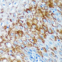 Invitrogen IER5 Polyclonal Antibody 100 &mu;L; Unconjugated:Antibodies,