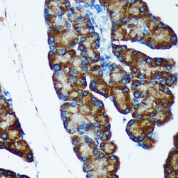 Invitrogen IER5 Polyclonal Antibody 100 &mu;L; Unconjugated:Antibodies,