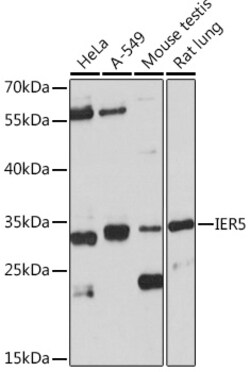 Invitrogen IER5 Polyclonal Antibody 100 &mu;L; Unconjugated:Antibodies,