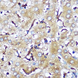 Invitrogen SERC1 Polyclonal Antibody 100 &mu;L; Unconjugated:Antibodies,