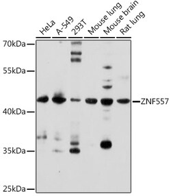 Invitrogen ZNF557 Polyclonal Antibody 100 &mu;L; Unconjugated:Antibodies,