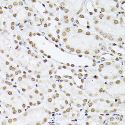 Invitrogen Histone H1T Polyclonal Antibody 100 &mu;L; Unconjugated:Antibodies,