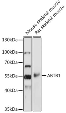 Invitrogen BPOZ Polyclonal Antibody 100 &mu;L; Unconjugated:Antibodies,