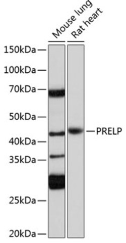 Invitrogen PRELP Polyclonal Antibody 100 &mu;L; Unconjugated:Antibodies,