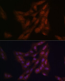 Invitrogen DJ-1 Polyclonal Antibody 100 &mu;L; Unconjugated:Antibodies,