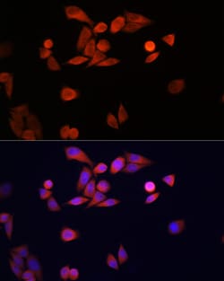 Invitrogen DJ-1 Polyclonal Antibody 100 &mu;L; Unconjugated:Antibodies,