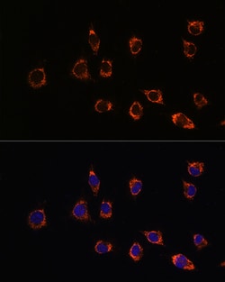 Invitrogen DJ-1 Polyclonal Antibody 100 &mu;L; Unconjugated:Antibodies,