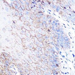 Invitrogen DJ-1 Polyclonal Antibody 100 &mu;L; Unconjugated:Antibodies,