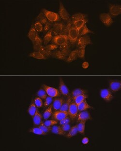 Invitrogen PKM1 Polyclonal Antibody 100 &mu;L; Unconjugated:Antibodies,