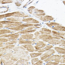 Invitrogen PKM1 Polyclonal Antibody 100 &mu;L; Unconjugated:Antibodies,