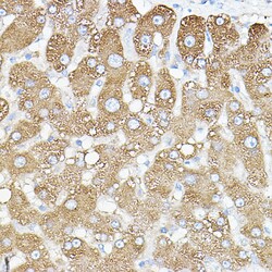 Invitrogen PKM1 Polyclonal Antibody 100 &mu;L; Unconjugated:Antibodies,