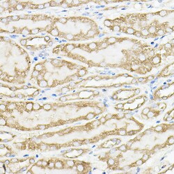Invitrogen PKM1 Polyclonal Antibody 100 &mu;L; Unconjugated:Antibodies,