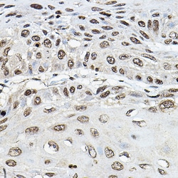 Invitrogen TRRAP Polyclonal Antibody 100 &mu;L; Unconjugated:Antibodies,