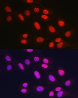 Invitrogen RAD21 Polyclonal Antibody 100 &mu;L; Unconjugated:Antibodies,