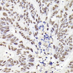 Invitrogen RAD21 Polyclonal Antibody 100 &mu;L; Unconjugated:Antibodies,